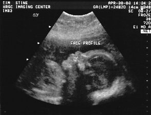 sonogram.jpg